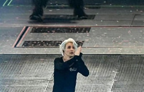 好恐怖！薛之谦晒头发真实状态！满头斑秃和水泡触目惊心