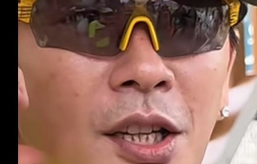 46岁演员黄宗泽“牙龈萎缩”引关注|潜行狙击|男神|许玮琛|机械性|生理性