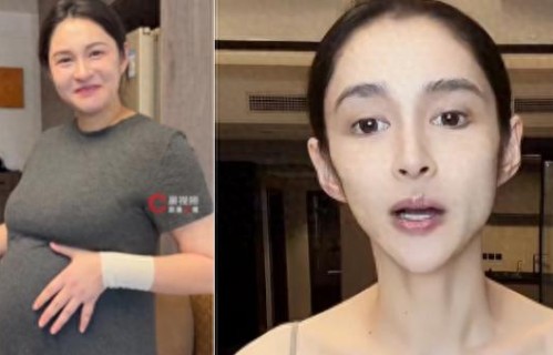 36岁女演员暴瘦80斤脱相！颧骨突出、双颊凹陷，网友惊呼“不敢认” 